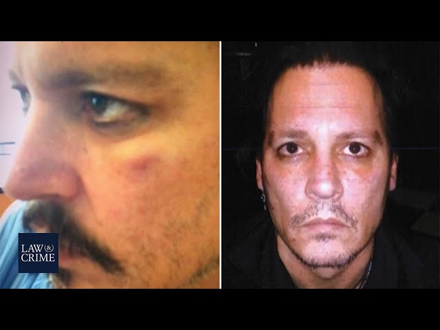 Photos of Johnny Depp's Injuries Presented in Court Today