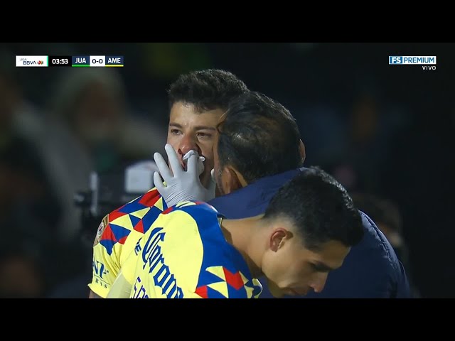 Illian Hernández cae lesionado en los primeros minutos | FC Juárez vs América | Liga MX