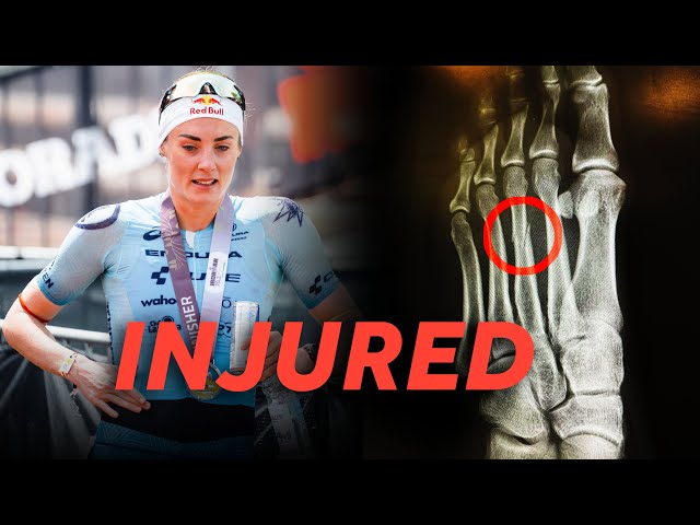 Freak Injury | Pro Triathlete
