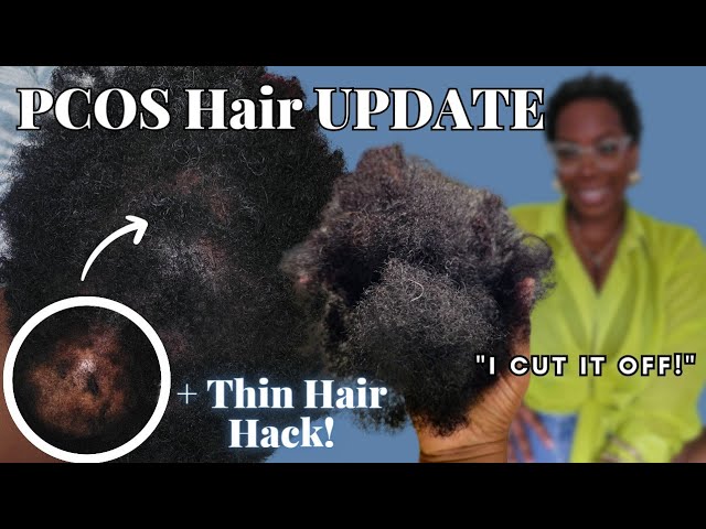 I CUT My Hair! PCOS Hair Loss Update NATURAL TWA Style HOW TO Hide Thin, Bald Spots + Natural Makeup