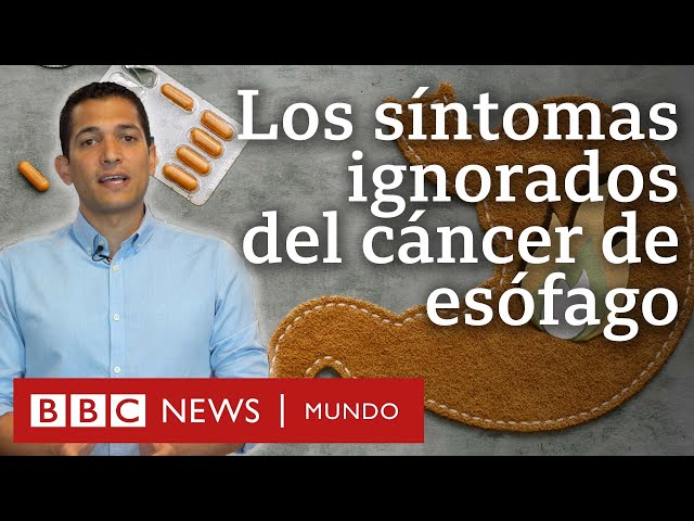 Cuáles son los síntomas del cáncer de esófago y por qué no debemos ignorarlos | BBC Mundo