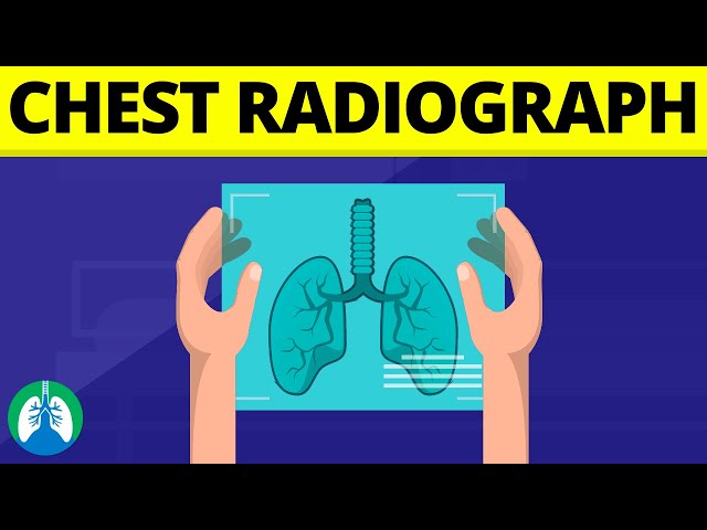 Chest Radiograph (Medical Definition) | Quick Explainer Video