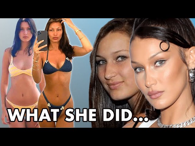 Bella Hadid Plastic Surgery UPDATE (2021): Ponytail Face Lift and Body Procedures