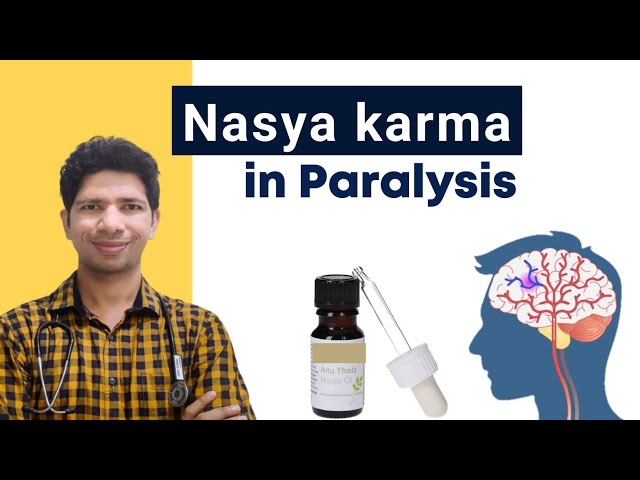 Treatment of Brain Stroke in Ayurveda :  Nasya Panchakarma (Errhine Therapy) #ayurved #Pakshaghat