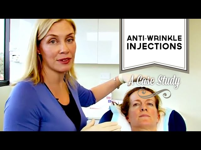 Case study - anti-wrinkle injections