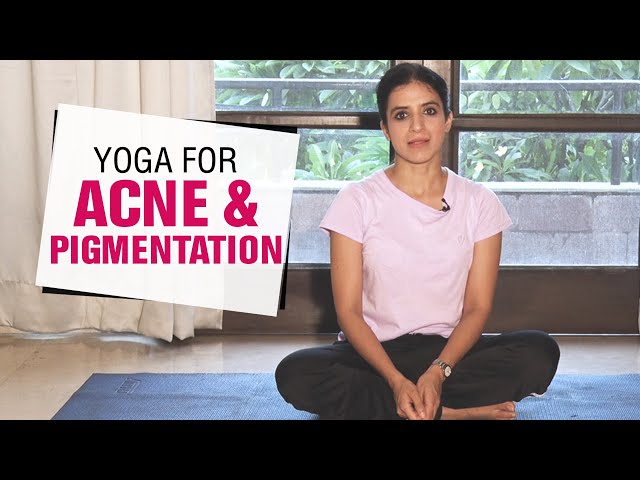 Facial Yoga to Treat Acne, Scars, and Pigmentation | Yoga for Skin Problems | Fit Tak