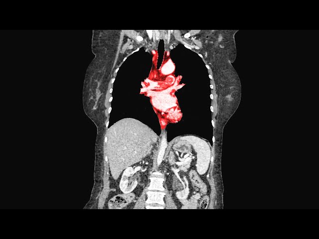 A Man Played Video Games Nonstop For 73 Hours. This Is What Happened To His Organs.