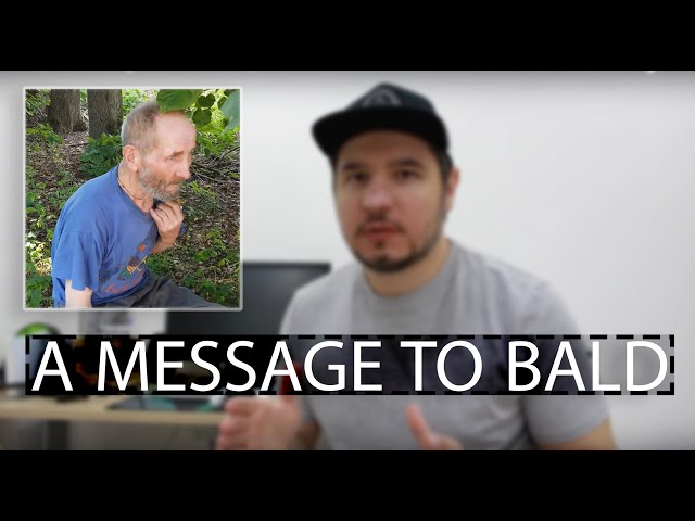 An important message to bald and bankrupt