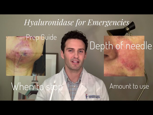 Injectors Guide: Hyaluronidase for Emergency Treatments!