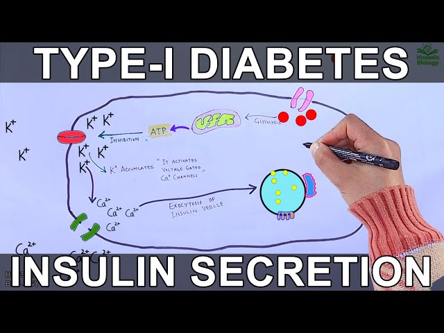 Type I Diabetes Mellitus | Mechanism