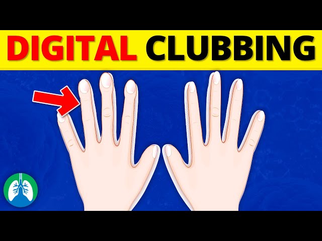 Digital Clubbing (Medical Definition) | Quick Explainer Video