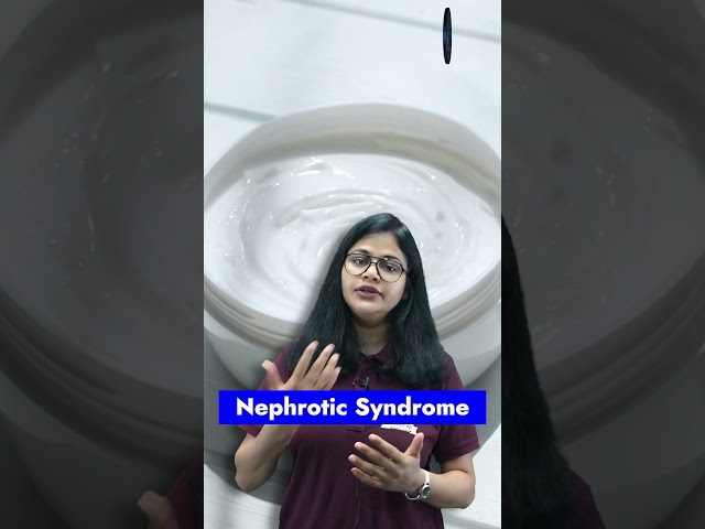 What Is Nephrotic Syndrome - Fairness Cream & Nephrotic Syndrome #dailycurrentaffairs #youtubeshorts