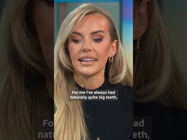 Faye Winter Talks About Her Experience with Botched Filler 'Tweakments.'