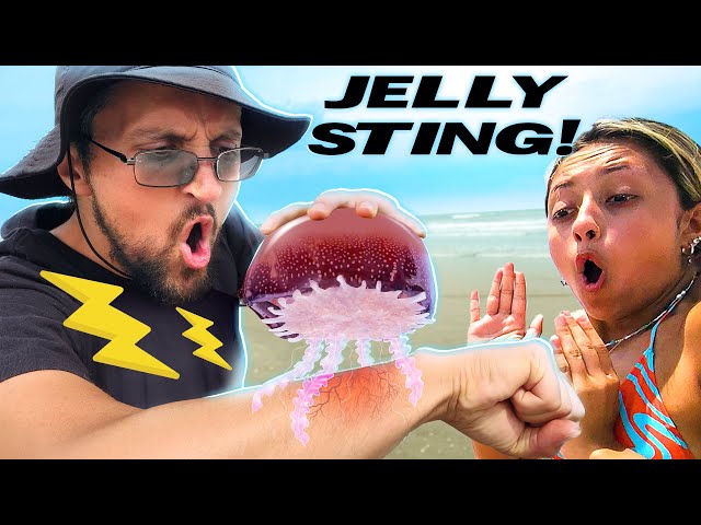 Stinging myself with Jellyfish to get Family Reactions (PRANK)