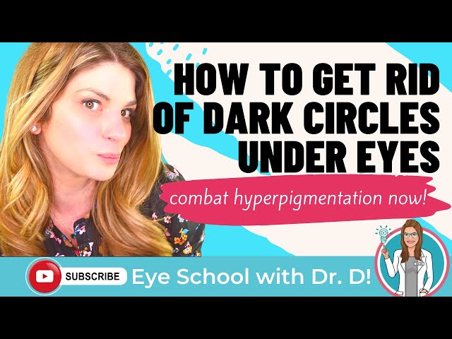 How to Get Rid of Dark Circles | How to Get Rid of Dark Circles Under Eyes | Eye Doctor Explains