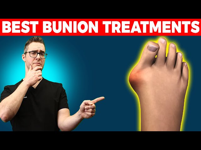9 BEST Bunion Treatments (NO Surgery)! [Splints, Correctors & Pads]