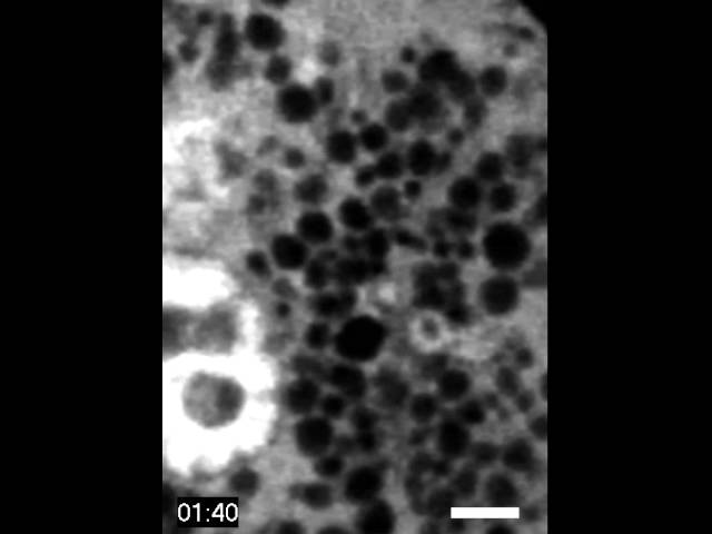 #NIDCR: Granules in a Salivary Acinar Cell