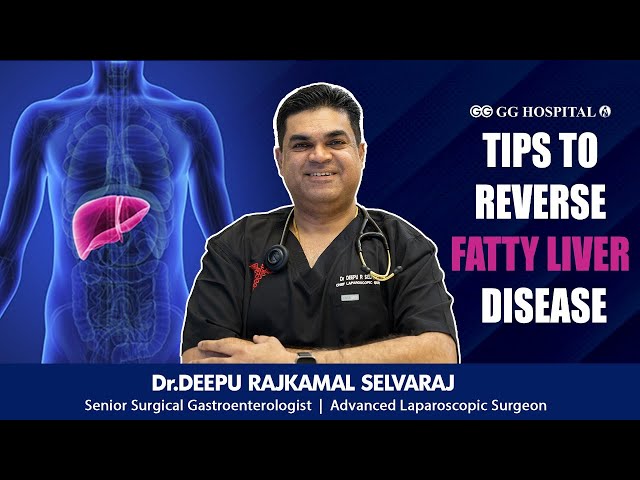 TIPS TO REVERSE FATTY LIVER DISEASE!!! - Dr Deepu Rajkamal Selvaraj| GG Hospital #fattylivertips