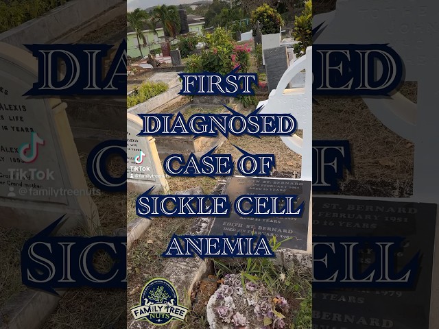 First Diagnosed Case of Sickle Cell Disease