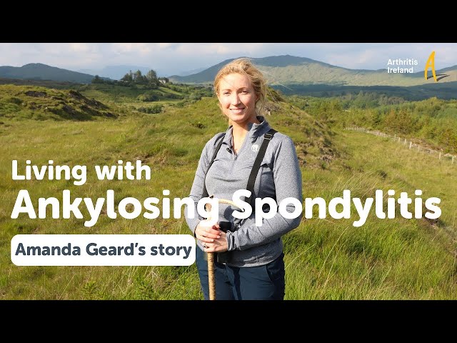 Living with ankylosing spondylitis - Amanda Geard's story