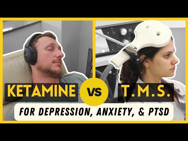 TMS vs. Ketamine: Which One Is Better?