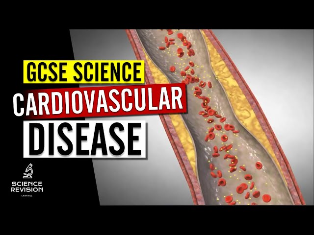 GCSE Science Biology (9-1) - Cardiovascular Disease and Treatment