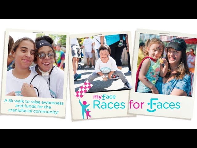 Races for Faces 2023