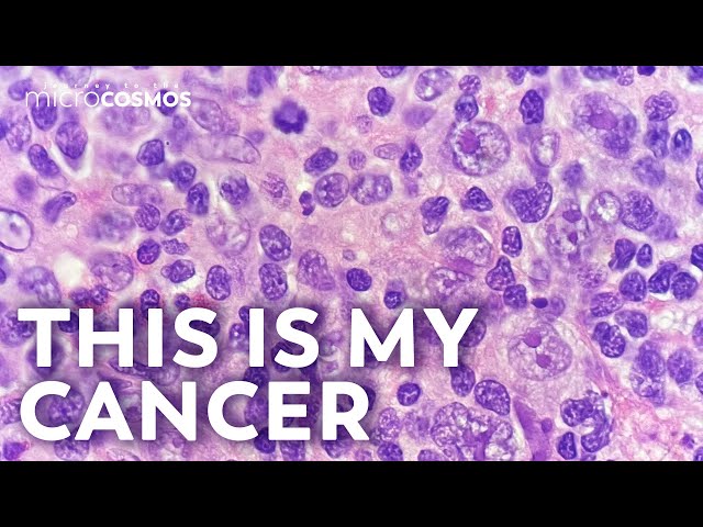 What Does Cancer Look Like?