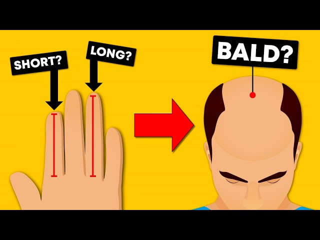 Does More Testosterone Make You Go Bald? DEBUNKED