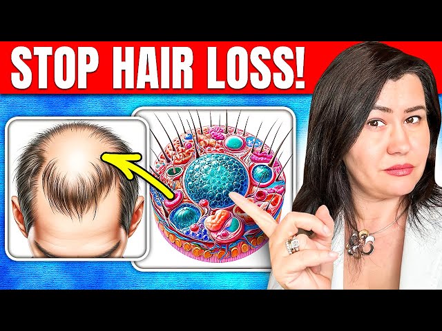 Autoimmune Diseases: The Truth About Hair Loss + BONUS New Approved Treatment