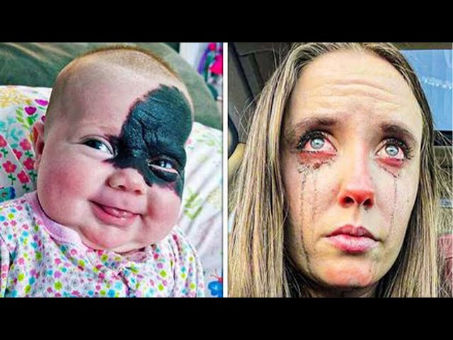 Woman Was Sure Her Son Passed Away just After Birth Recognizes His Birthmark On Facebook 3Years Late