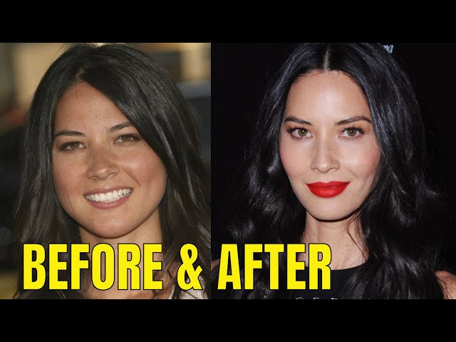 Olivia Munn: Plastic Surgery - WHAT CHANGED? - Admits to Invisalign (Only)