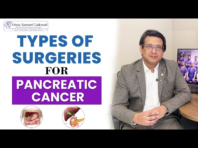Types of Surgeries for Pancreatic Cancer by Dr. Vinay Samuel Gaikwad #pancreatic #cancer #oncology