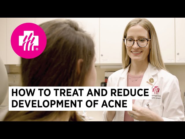 Acne Treatment and Popping Your Pimples