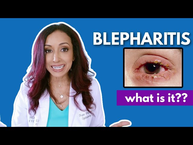 What Is Blepharitis? Eye Doctor Explains