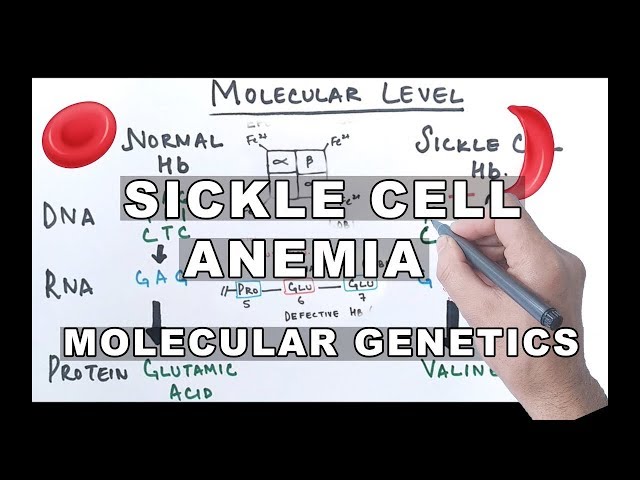 Sickle Cell Anemia - Molecular Mechanism