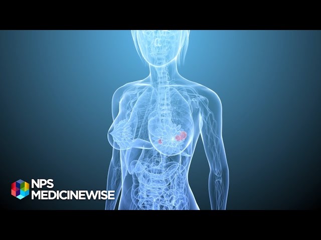 Breast tenderness and  hormone replacement therapy (HRT) - from Tonic TV
