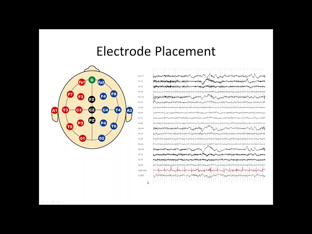 Understanding the EEG