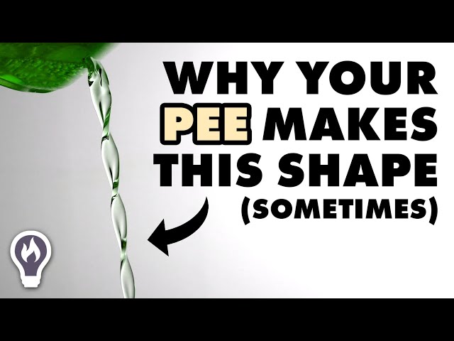 Why Your Pee Looks Like A Chain
