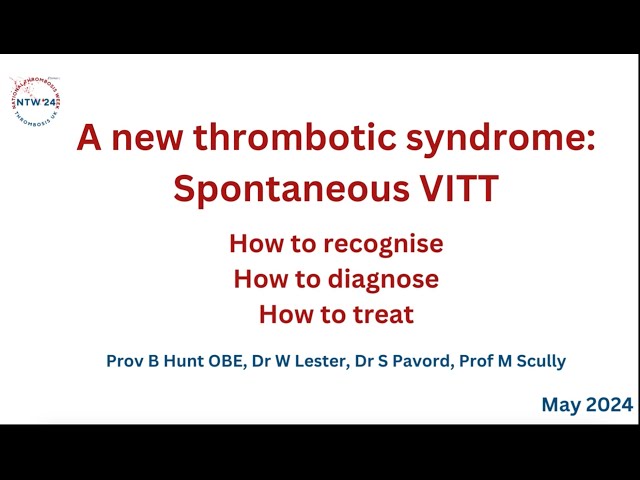 A new thrombotic syndrome Spontaneous VITT