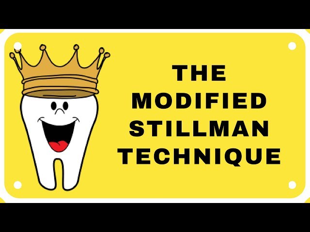Modified Stillman Technique