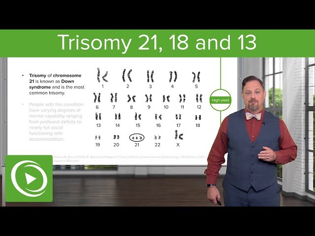 Chromosomal Abnormalities: Trisomy 21,18 & 13 – Embryology | Lecturio