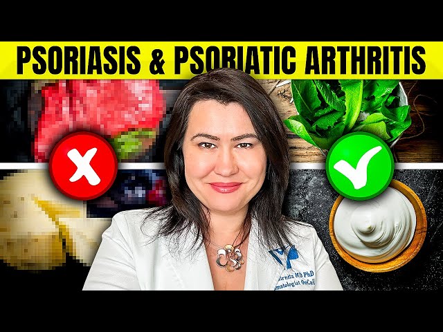 Top 8 Foods Causing Worsened Psoriasis And Psoriatic Arthritis