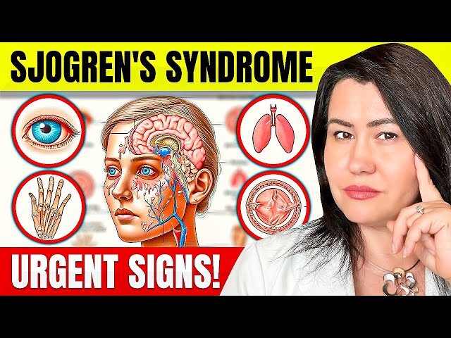 10 Vital Signs of Sjogren's Syndrome You Can't Ignore