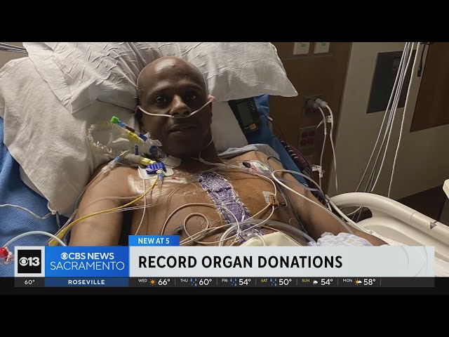 California organ donor service reaches record transplants in 2023