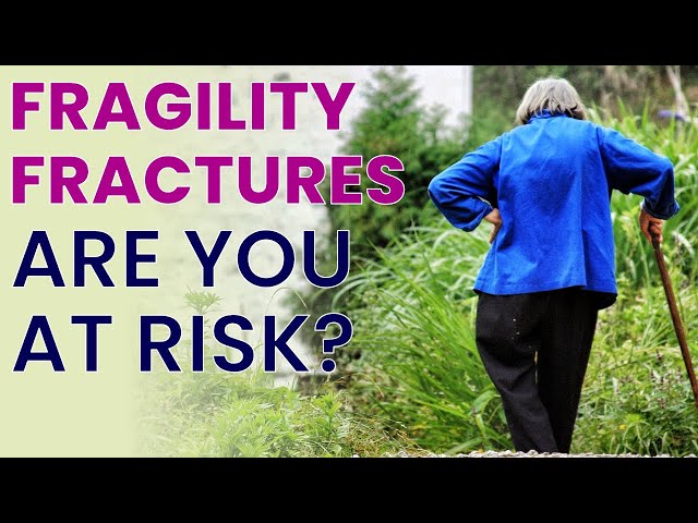 What is Your Risk of Fragility Fracture?