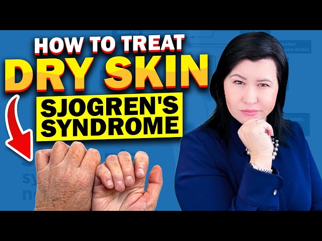Dry Skin in Sjogren's Syndrome.