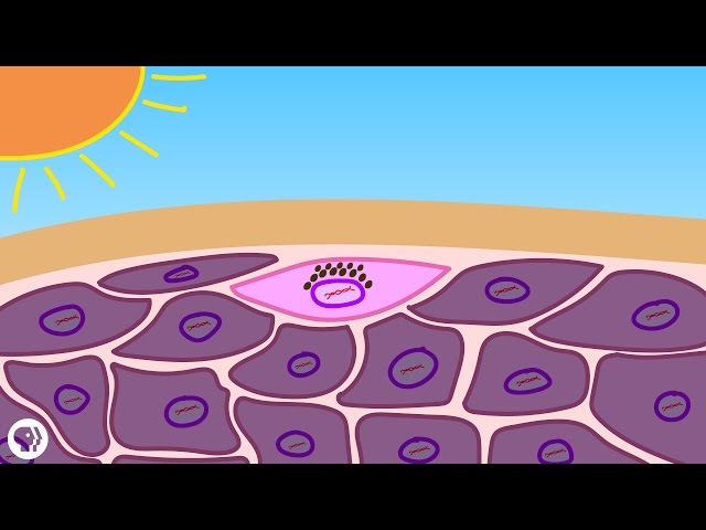What Really Causes Sunburns?