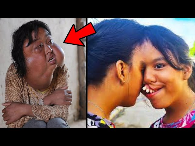 10 Most Shocking People You Won’t Believe Exist