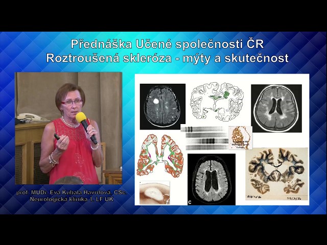 Eva Kubala Havrdová: Roztroušená skleróza – mýty a skutečnosti